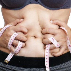 Sagging Skin: A Result of Rapid Weight Loss